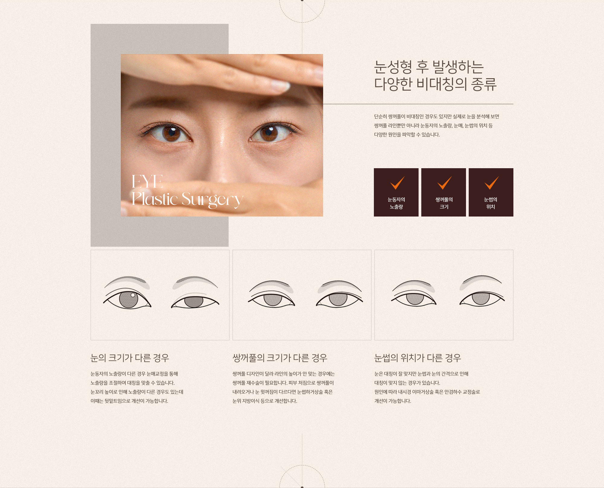 비대칭교정